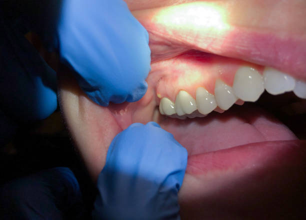  Saltville, VA Emergency Dentist Pros